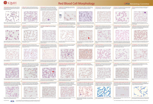 Red Blood Cell Morphology Wall Chart